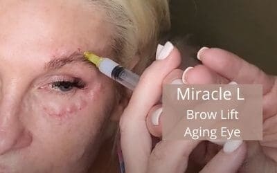 Miracle L – Brow Lift and Aging Eye