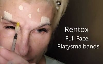Rentox – Full Face and Platysma bands