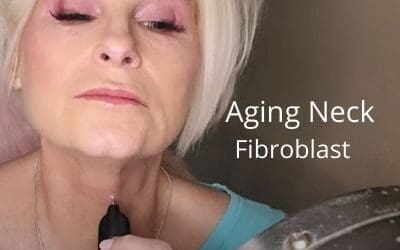 Turkey Neck – Aging neck – Fibroblast