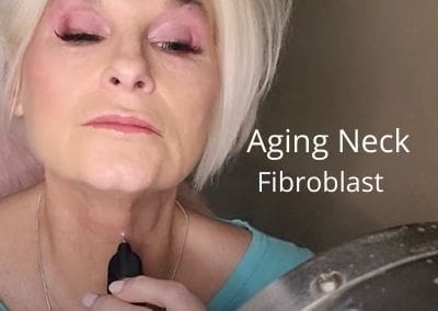 Turkey Neck – Aging neck – Fibroblast