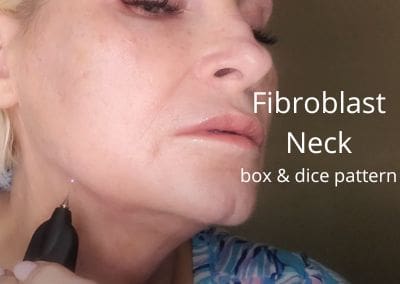 Fibroblast Neck
