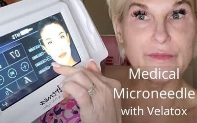 Medical Microneedle with Velatox
