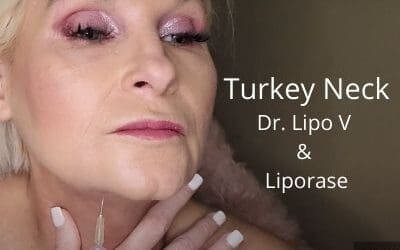Turkey Neck – Dr. Lipo V & Liporase