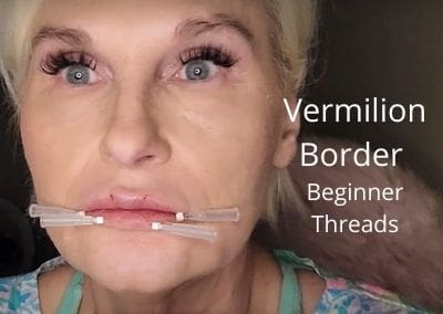 Vermilion Border – Beginner Threads