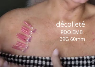 décolleté – PDO EMB 29G 60mm
