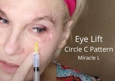 Eye Lift – Miracle L – Circle C Pattern