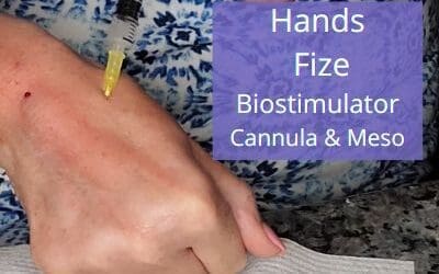 Hands – Fize Biostimulator with Cannula & Meso