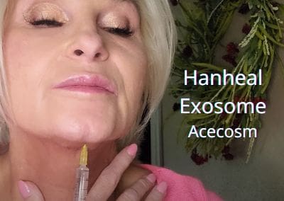 Hanheal EXOSOME from Acecosm
