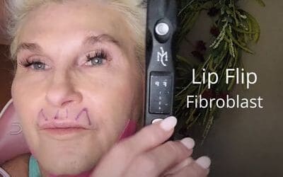 Lip Flip – Fibroblast