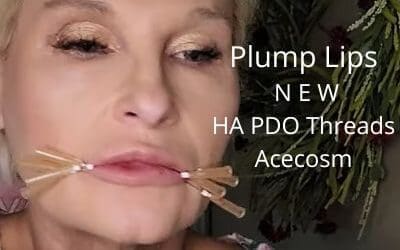 Plump those Lips with NEW HA PDO threads from Acecosm