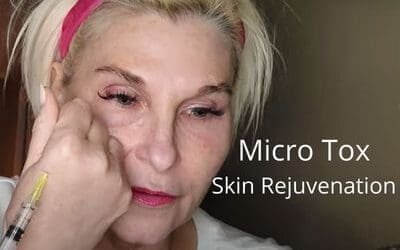 Skin Rejuvenation with Micro Tox