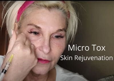 Skin Rejuvenation with Micro Tox
