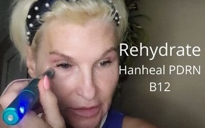 Rehydrate Skin – Hanheal PDRN & B12