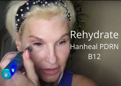 Rehydrate Skin – Hanheal PDRN & B12
