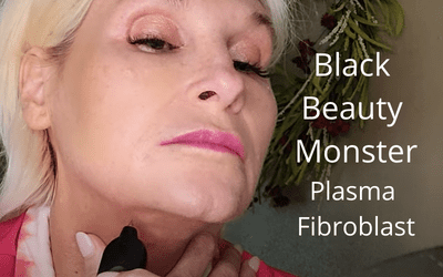 Black Beauty Monster – Plasma Fibroblast