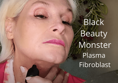 Black Beauty Monster – Plasma Fibroblast