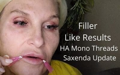 Filler Like Results with HA Mono Threads & Saxenda Update