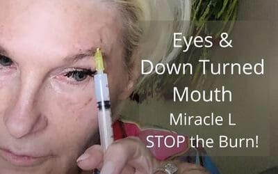 Miracle L – Stop the Burn.  Circle C Pattern & Down Turned Mouth