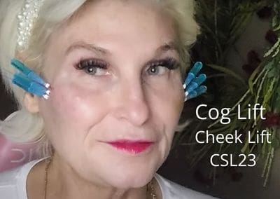 Cheek Lift – CSL23 Cog Thread Lift