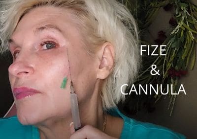 Fize PLA – Working with a Cannula