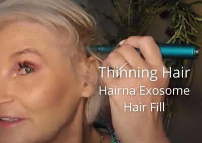 Treating Thinning Hair with Hairna Exosome Hair Fill from Glamcosm