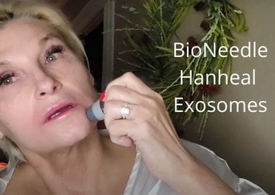 Hanheal Exosome – Using BioNeedle