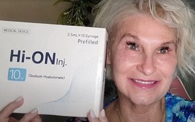 Cheek Rejuvenation with HI-ON Inj from Glamcosm