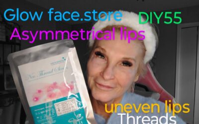 Asymetrical Lip Treatment with PDO Mono Threads