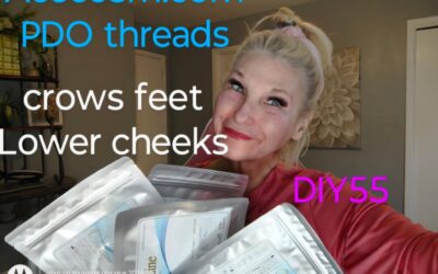 Lifting Threads for Crows Feet and Cheeks