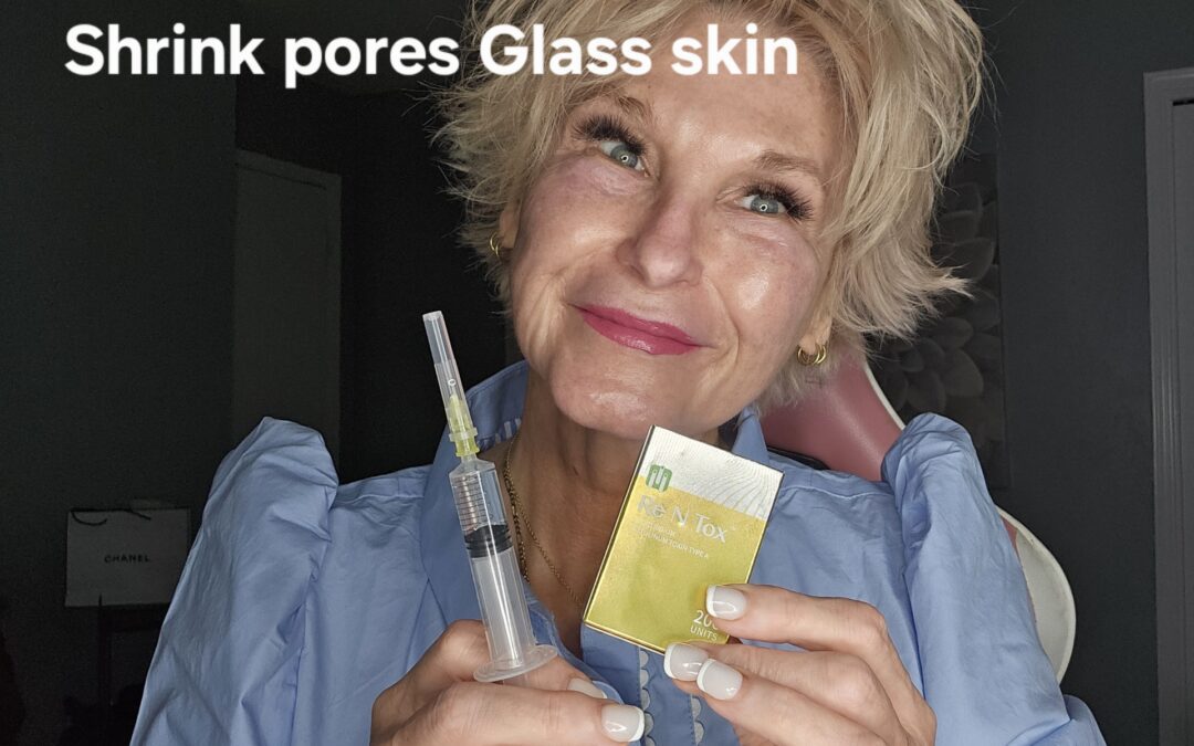 Safe “Baby Tox” Technique