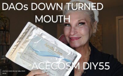 DAO and Neck Lift with PDO Threads