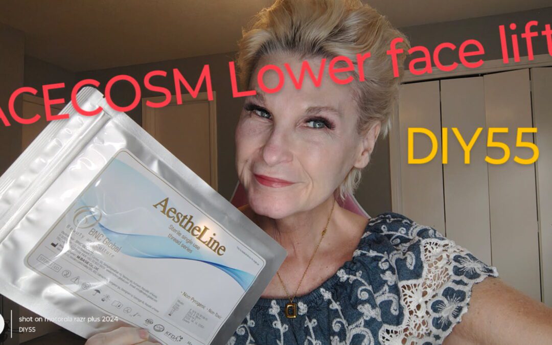 Lower Face Lift with 23g 60mm PDO Cogs