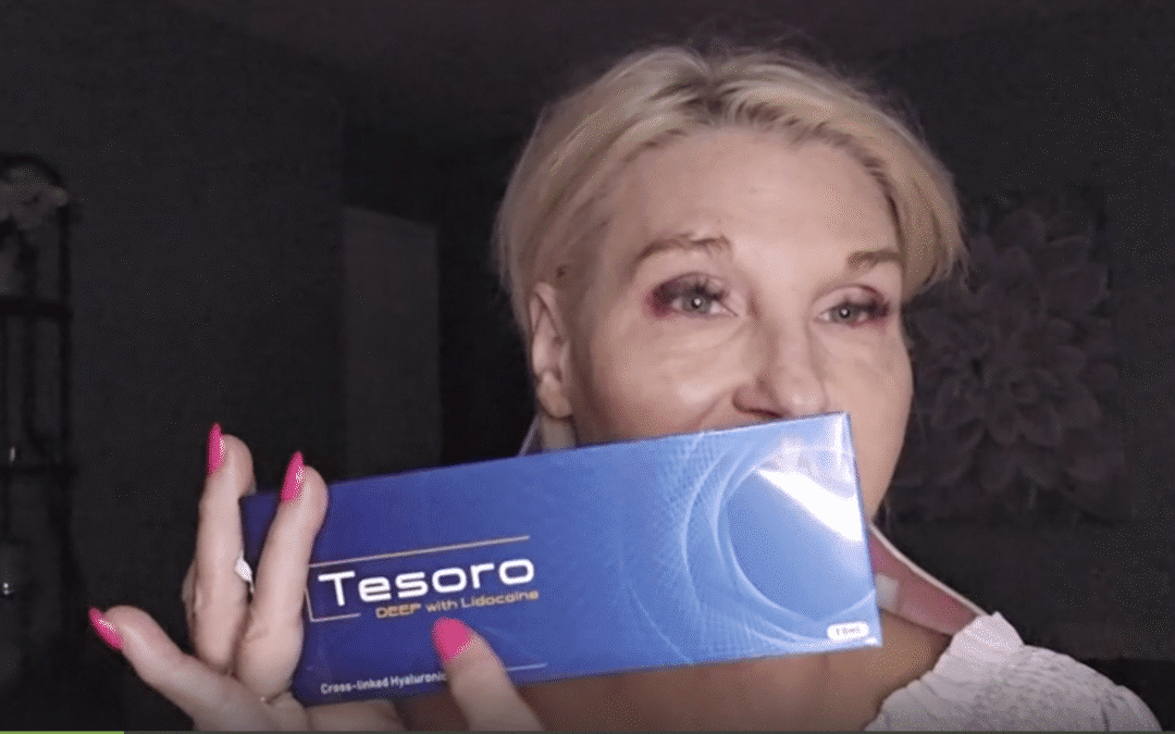 Lip Enhancement with Tesoro Deep