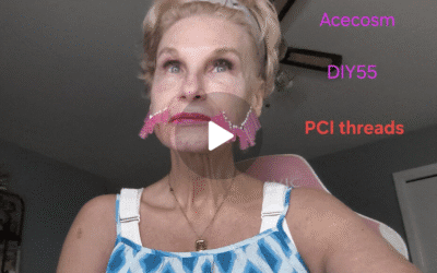 Cheek Lift with PCL Threads From AceCosm