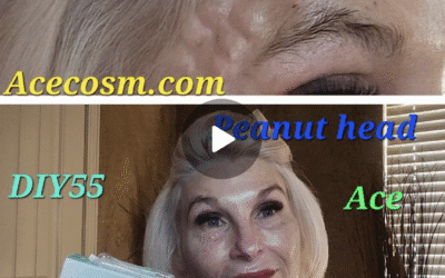 Temple Treatment with Juve Eyes