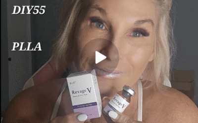 Revage V: Using Filler for Cheeks