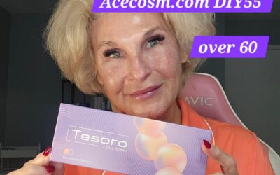 Orbital Area and Crows Feet Meso with Tesoro Collagen