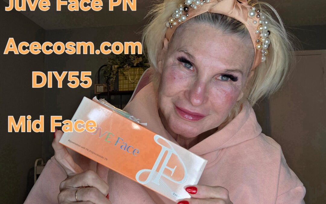 Juve Face Meso for Mid Face Volume