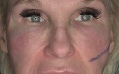 Face Lift with 21g 90mm Cogs