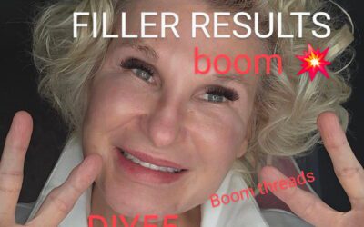 Threading DAOs and NLFs with Boom Threads