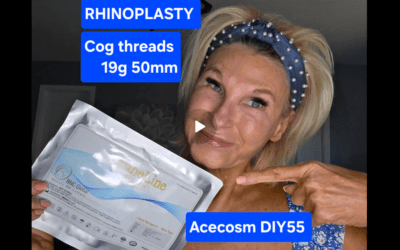 DIY Nose Thread Lift: My First Rhinoplasty with PCL Rhino COGs